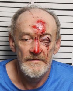 Anderson, Ronnie Gale - Aggravated Assault X 2; Evading Arrest; DUI
